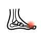 Arthrite